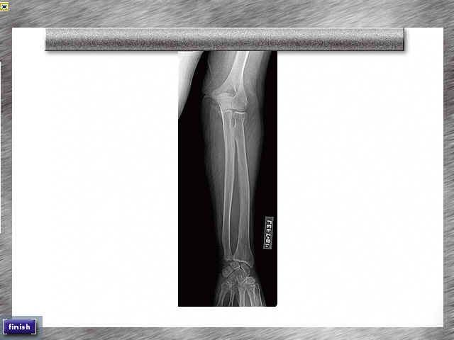 Code Blue (Windows) screenshot: The x-ray doesn't show much bone damage.