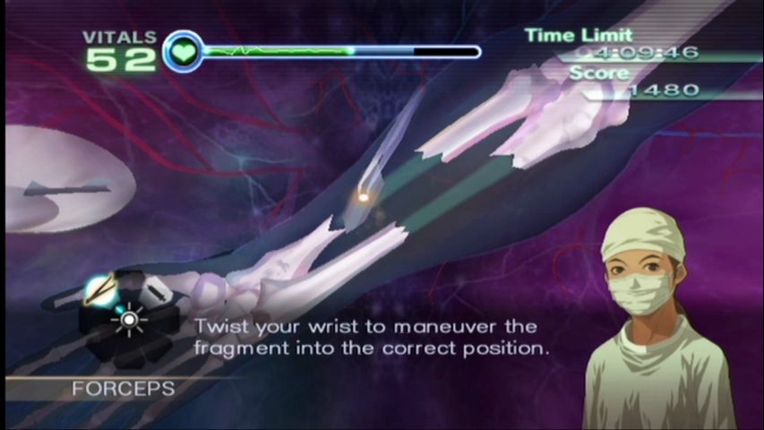 Trauma Center: New Blood (Wii) screenshot: Tilt fragments with the Wii remote.