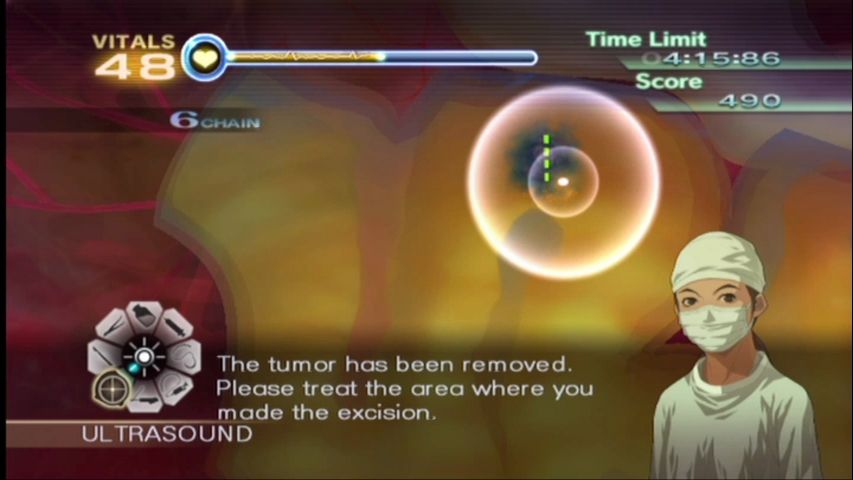 Trauma Center: New Blood (Wii) screenshot: Finding hidden tumors with the ultrasound.