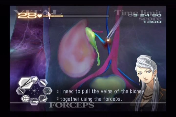 Trauma Center: Second Opinion (Wii) screenshot: It's not all crazy GUILT challenges. Here's a "standard" kidney transplant.