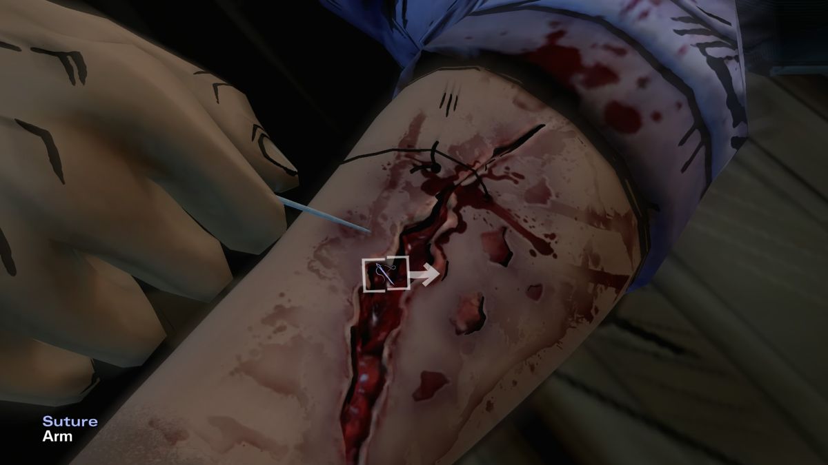 The Walking Dead: Season Two (PlayStation 4) screenshot: Episode 1 - Suturing your wound with great pain