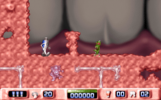 ARO und ELMI im Kampf gegen die Bakterien Bande (DOS) screenshot: First level of the Gum World.