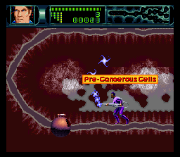 Rex Ronan: Experimental Surgeon (SNES) screenshot: Helpful pop-up labels indicate what you're supposed to mop up