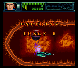 Rex Ronan: Experimental Surgeon (SNES) screenshot: Teleporting out of my vessel