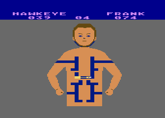 M*A*S*H (Atari 8-bit) screenshot: Save the patient by removing shrapnel.