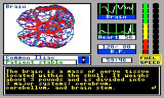 Laser Surgeon: The Microscopic Mission (TRS-80 CoCo) screenshot: About the brain...