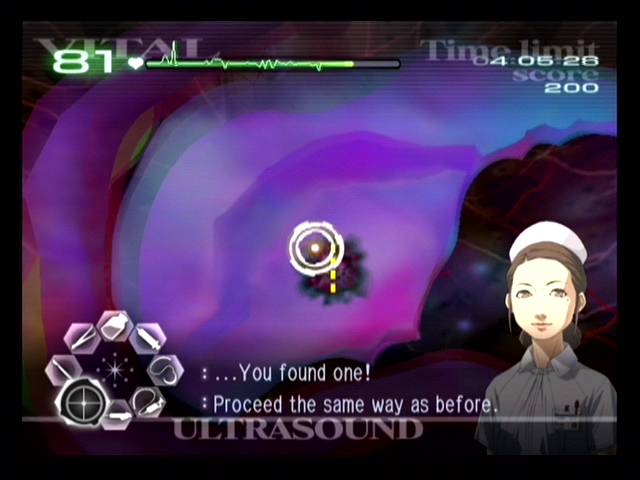 Trauma Center: Second Opinion (Wii) screenshot: Using an ultrasound to find trouble...