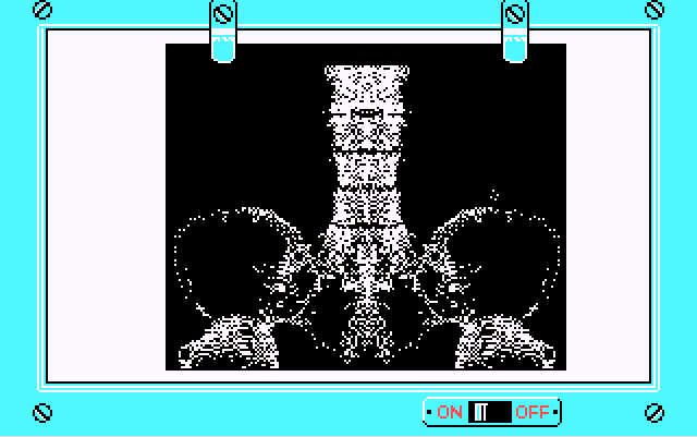 Life & Death (DOS) screenshot: X-Ray