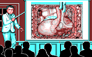 Life & Death (DOS) screenshot: Med school again... cut here with the scalpel to reveal the mesoappendix artery.