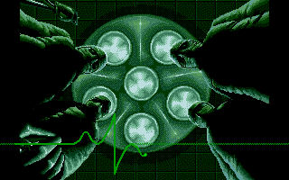 Weird Dreams (DOS) screenshot: Intro: a bunch of concerned medics check Steves condition.