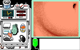 Life & Death (Apple IIgs) screenshot: Ready, aim...operate!